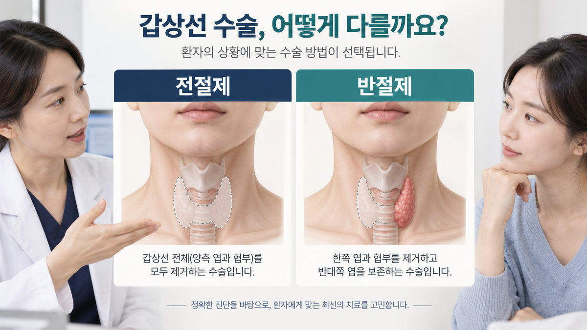 갑상선암 전절제와 반절제에서 제거하는 갑상선 범위 비교