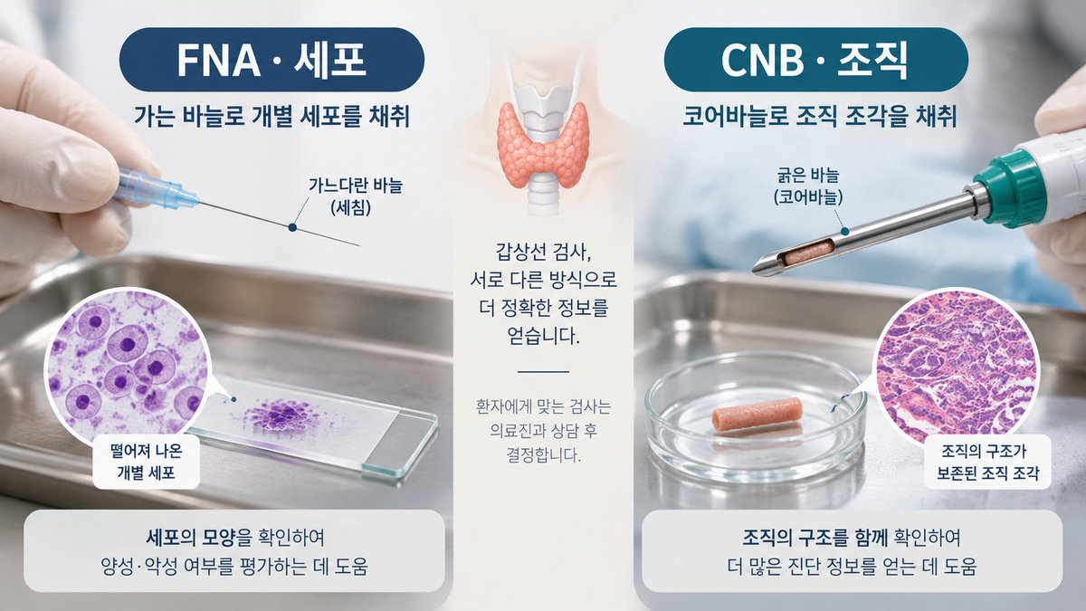 갑상선 세침검사 FNA 코어바늘생검 CNB 차이 세포 조직 비교