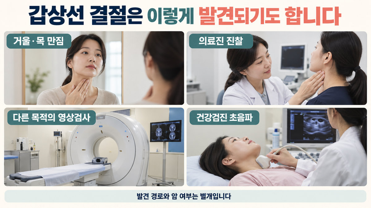 갑상선 결절이 목 혹 진찰 영상검사 건강검진에서 발견되는 경로