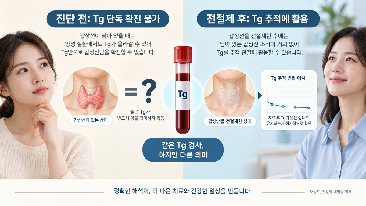 갑상선글로불린 Tg 진단 전 전절제 후 갑상선암 추적 비교