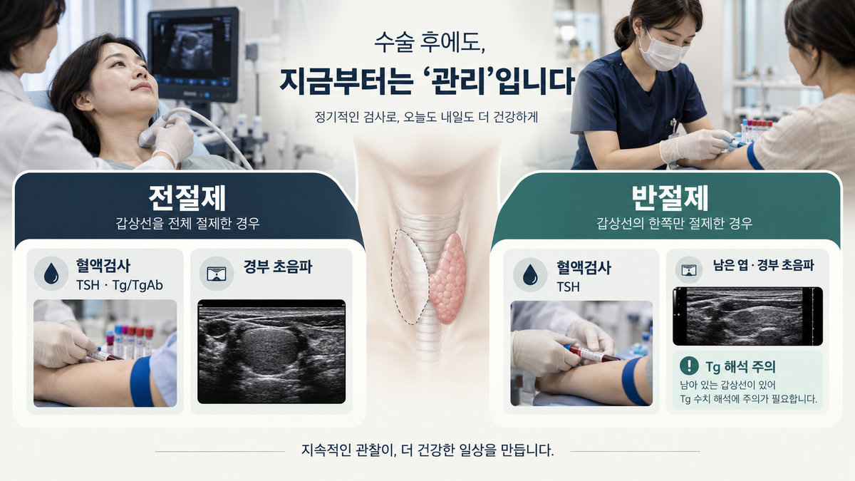 갑상선암 전절제와 반절제의 초음파 TSH Tg 추적검사 차이